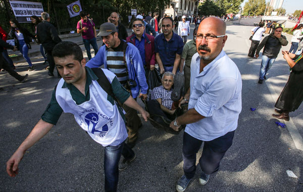 Turquie : plus de 95 morts et 250 blessés dans un double attentat à Ankara