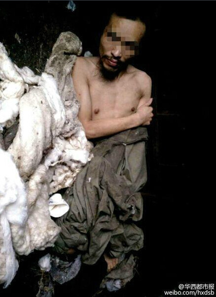 Un malade mental qui avait tué son père est resté enfermé 24 ans dans une cage