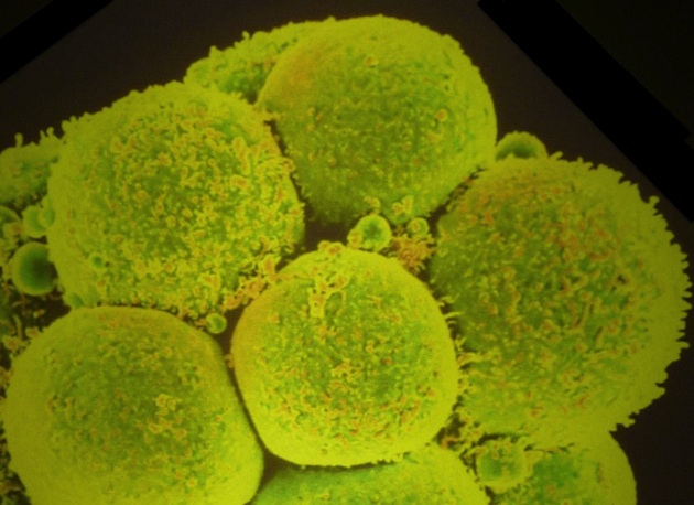 Des embryons humains génétiquement modifiés pour résister au sida 