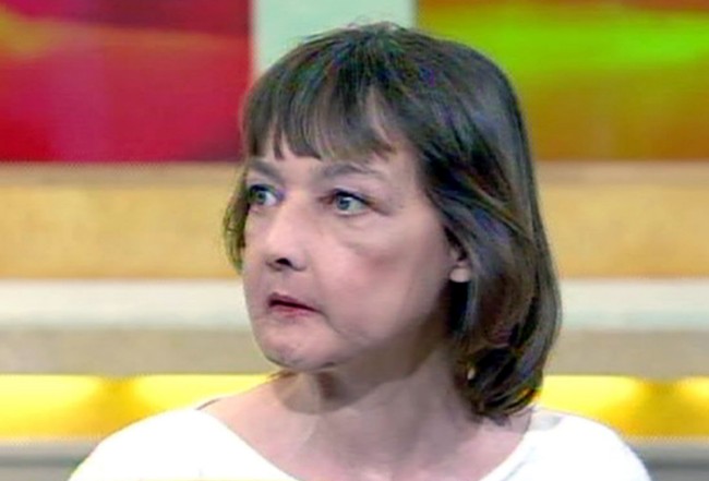 Décès de la première femme greffée du visage 