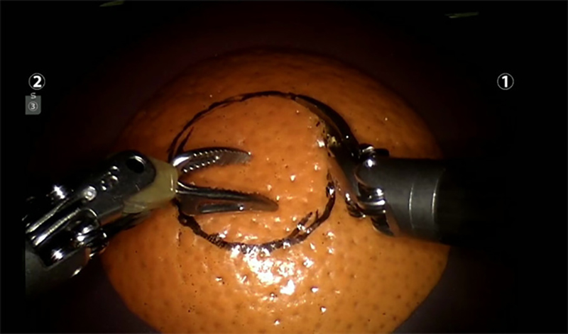 Un médecin chevronné épluche, coupe et coud une peau d'orange avec un robot